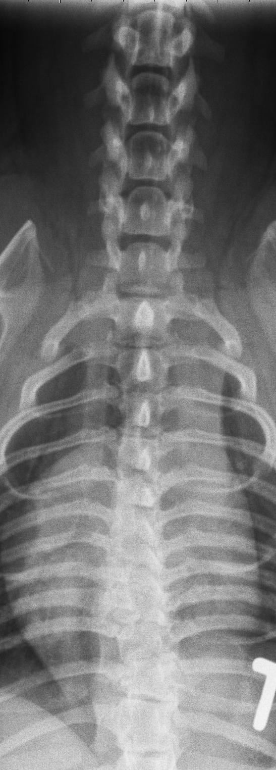 Röntgenbild von oben, Fokus Brustkorb