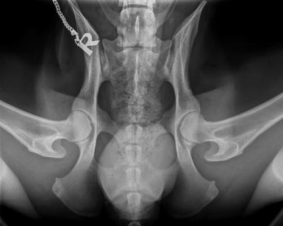 Röntgenbild einer Hüftgelenksdysplasie gebeugt