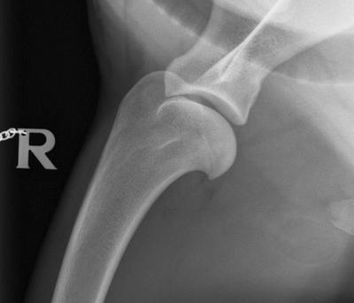 Röntgenbild einer Schulterosteochondrose-Aufnahme mediolateral